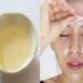 Làm trắng cấp tốc với trứng gà tiện lợi