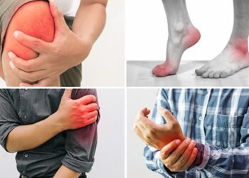 Viêm khớp: nguyên nhân, triệu chứng, các phòng bệnh