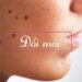 Cách trị đồi mồi bằng dưa chuột