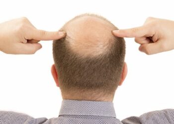 Cách trị rụng tóc bằng vỏ bưởi