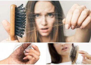 Nguyên nhân gây rụng tóc