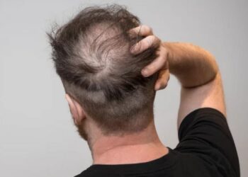 Hướng dẫn nấu nước trà lá ổi trị rụng tóc hiệu quả