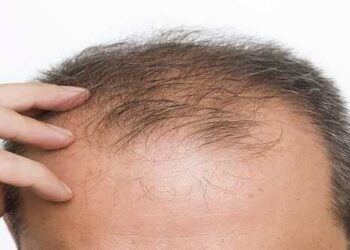 Dầu dừa trị rụng tóc không?