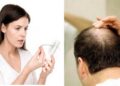 Rụng tóc mang đến nỗi lo cho cả nam và nữ