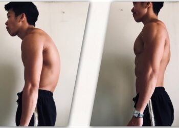 Bài tập tư thế rắn hổ mang giúp chữa gù lưng