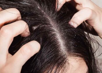 7 Nguyên nhân da đầu bị ngứa và cách điều trị hiệu quả