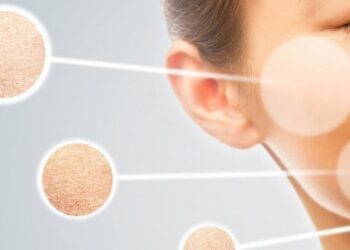 11 Cách điều trị da khô tại nhà, an toàn, hiệu quả cao