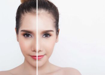 Da đen tự nhiên làm sao để trắng